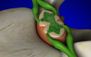 Что представляет собой дуральный мешок позвоночника?